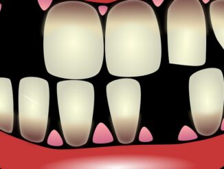 تفسير حلم سقوط الأسنان